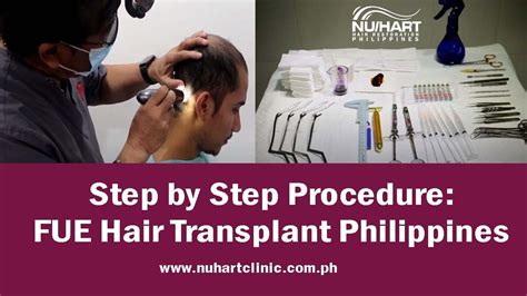FUE Hair Transplant Philippines .